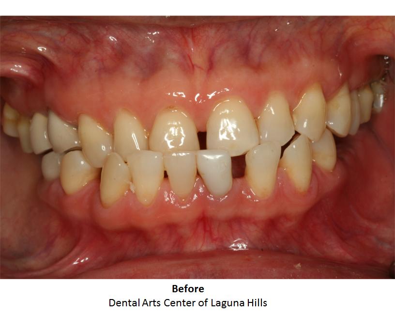 Dental Arts Center Of Laguna Hills