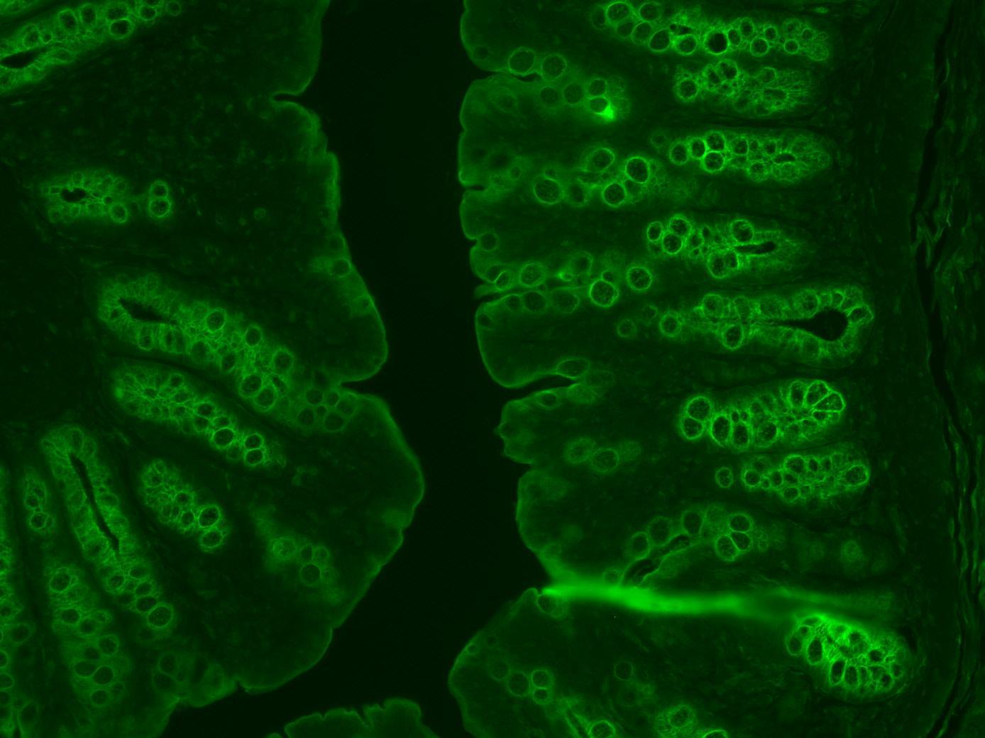 Rat Colon using a new fluorescent compound