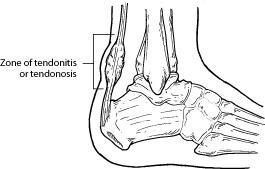 North Suburban Foot & Ankle Center: Dr Jared M Maker, DPM, Facfas