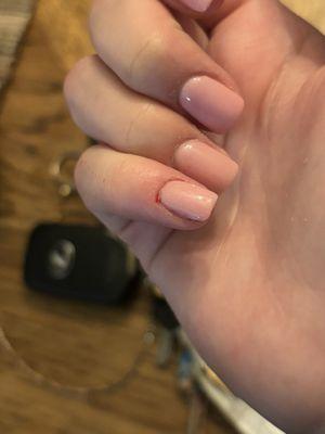 My nail after it stopped gushing blood, you can see how deep I got cut.