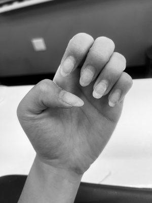 How my nails looked coming in. This was after she shaved them down the first time.