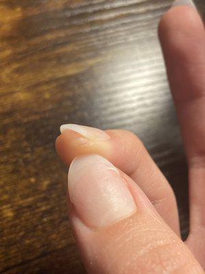 A cut on my pinky n a hair glued on my nail‍