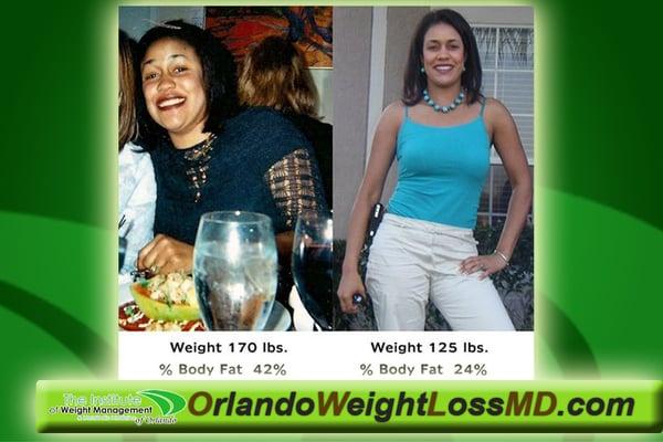 Dr.Green Before and After her Weight Loss in Orlando