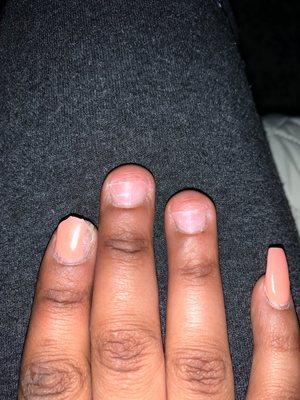 My nails was ripped beyond the meat!!! And my pointer finger is killing me because that one feels broken underneath as well