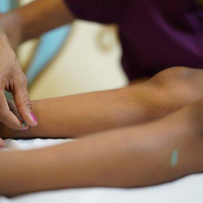 Children don't mind getting 'tapped' or needled