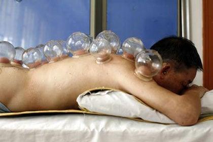 Cupping for detox