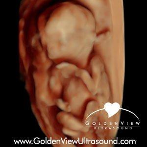 3d/4d Ultrasound with HDLive imaged at GoldenView Ultrasound. Baby is 15 weeks