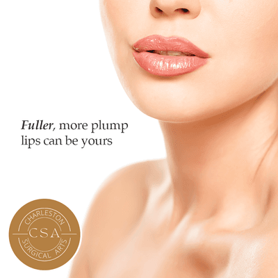 Lip Augmentation