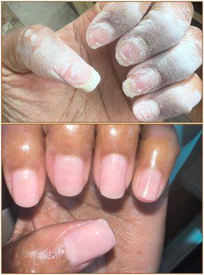 Removed dip tips & basic manicure.