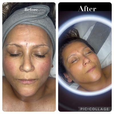 Refine and Recover Facial