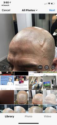 Scalp Aesthetics Micropigmentation Studio At Chase Tower