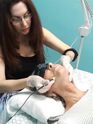 Removing facial hair on a female client with electrolysis