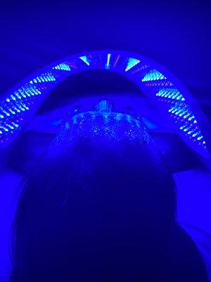 Blue LED Therapy to treat acne