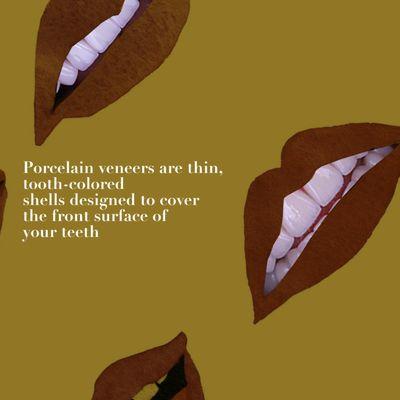 Porcelain Veneers Poster