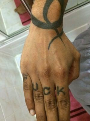 FreshStart Applicant hand tats to be removed.