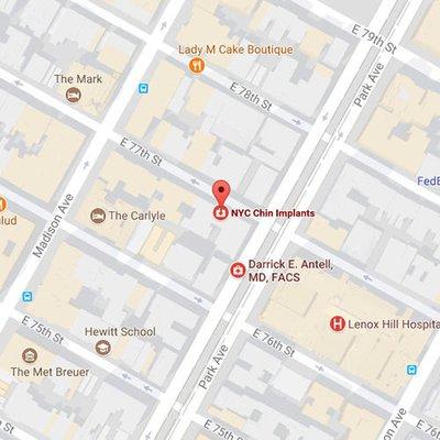 Our chin implant office is located at 80 East 77th Street in New York City.