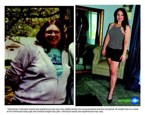 Valley Medical Weight Loss