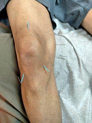 Desert Ridge Acupuncture