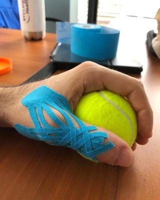 Kinesiotape for reducing pain and swelling after a flare up of thumb joint osteoarthritis