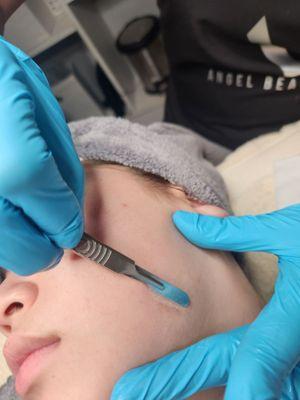 Dermaplaning Facial