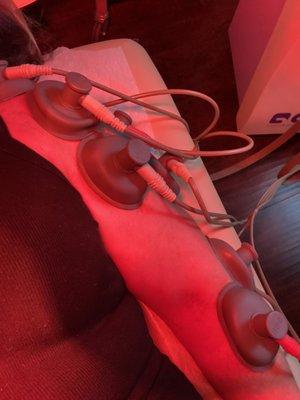 Electrical Stimulation