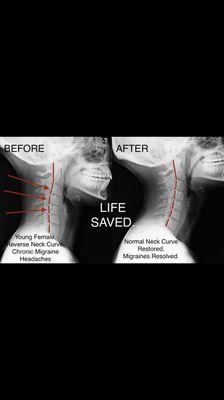 Structural Chiropractic