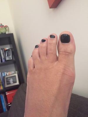 Week three after getting a pedi!!!