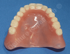 Repaired denture