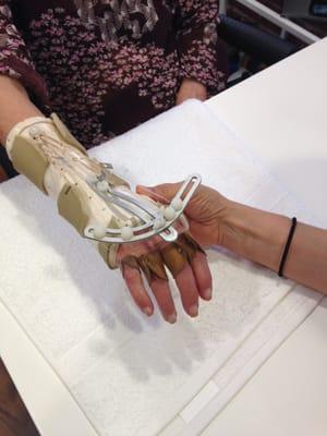 Custom Fabricated Dynamic Splint