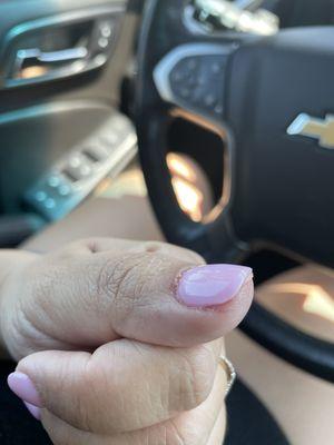 Skin under my thumb nail exposed