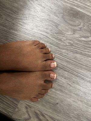 1 week after pedicure