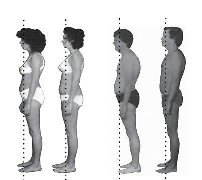 Before/After Rolfing (stock photo)