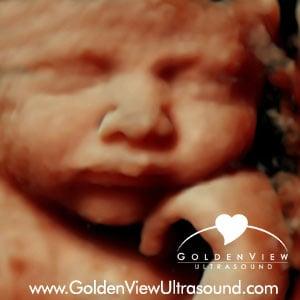 3d Ultrasound with HD live at 35 weeks