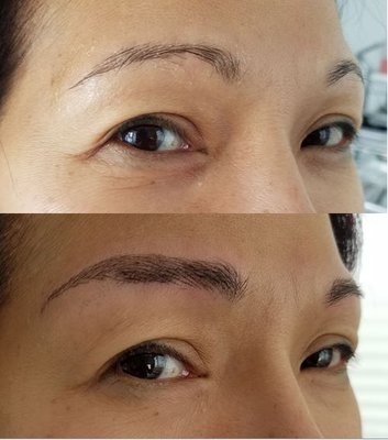 Dedicated nurse got a well-deserved "brow-lift" to fix the drooped shape from years' overplucking. (Darker patches are her dense hairs.)