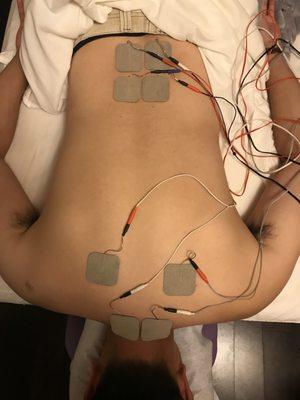 electrical stimulation