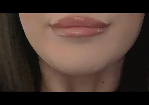 My lips look amazing!