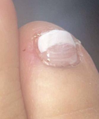 She cut the side of my toe. And look at my nail. Horrible!!!