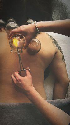 Cupping