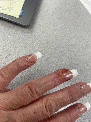 Clean your equipment Crystal Nail.