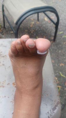 The "fixed" toenail