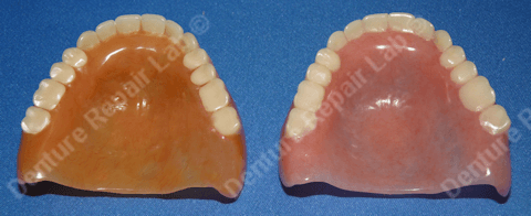 Duplicate dentures