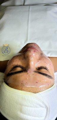 Custom Hydrating Facial