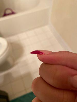 Poor quality nail