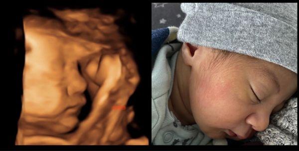 Comparing 3D ultrasound and newborn :)