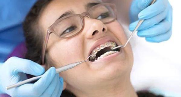 Metal braces are the most common type of orthodontic treatment used to straighten teeth.