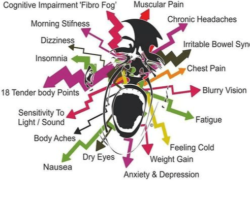 Fibromyalgia pain gone with PEMF