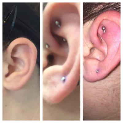 Before, right after and two days after. You can see the jewelry for my forward helix just fits in the right after photo.