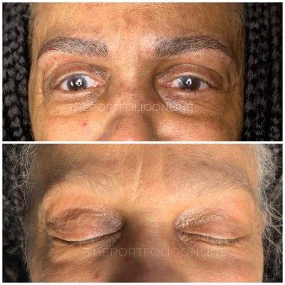 Microblading