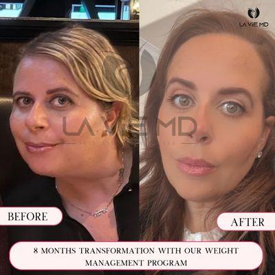 Transformation with Semaglutide in 8 months.