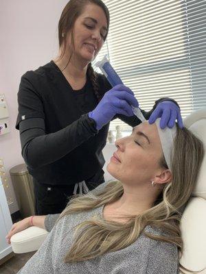 SkinPen Microneedling